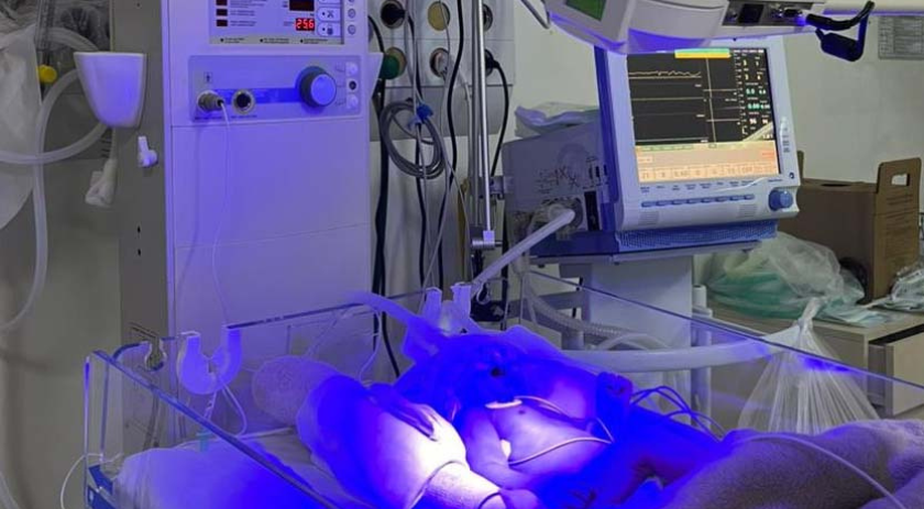 Hospital Regional inicia testes da UTI Neonatal Neurológica, pioneira na rede