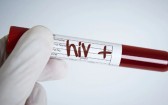 Homem é condenado a pagar R$ 60 mil após transmitir HIV à ex-companheira