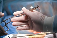 Mulher será indenizada após passar 5 anos com objeto dentro do corpo depois de cirurgia