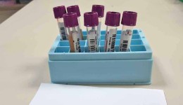 Fevereiro Laranja alerta para leucemia e reforça importância do diagnóstico precoce