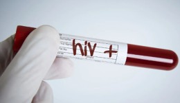 Homem é condenado a pagar R$ 60 mil após transmitir HIV à ex-companheira