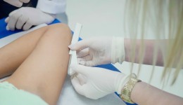 Município amplia acesso a implante contraceptivo em unidades de saúde