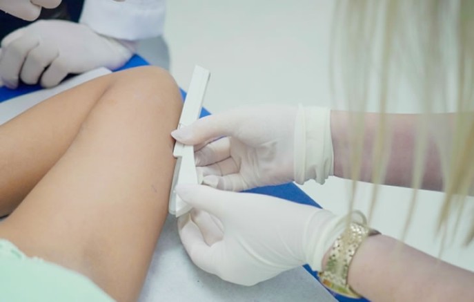 Município amplia acesso a implante contraceptivo em unidades de saúde