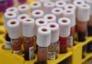 Junho Vermelho: Secretaria de Saúde reforça importância da doação de sangue