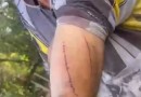 Agricultor de 76 anos sobrevive após lutar com onça-parda no Paraná