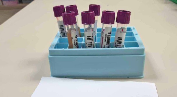 Fevereiro Laranja alerta para leucemia e reforça importância do diagnóstico precoce