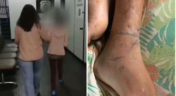Filho acorrentado pela mãe ficava dias sem comer, sem beber água e vivia situações de extremo sofrimento, diz delegada