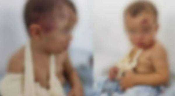 Mãe é presa por suspeita de ter torturado o filho de 2 anos