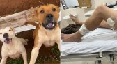 Homem sofre ferimentos graves ao ser atacado por cães pit bull; tutor deverá responder por omissão