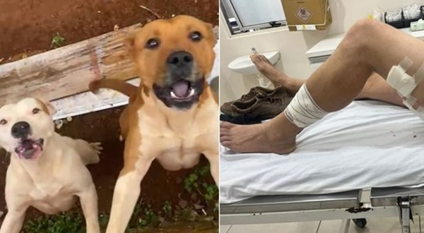 Homem sofre ferimentos graves ao ser atacado por cães pit bull; tutor deverá responder por omissão