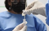 Fiocruz aponta sinais de queda em alta recente da covid-19 no Brasil
