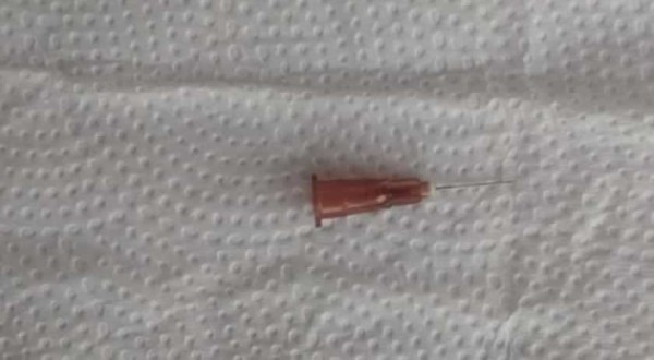 Bebê de SC que teve agulha “esquecida” no quadril passa por exame de corpo de delito