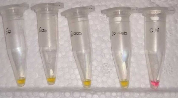 Teste para Covid mais barato e rápido do que o PCR é desenvolvido em SC