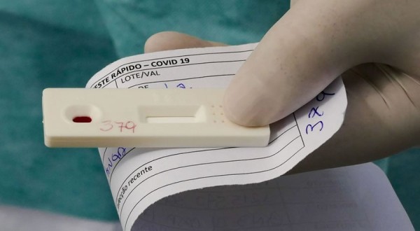 Procons alertam sobre abuso nos preços de exames de Covid-19