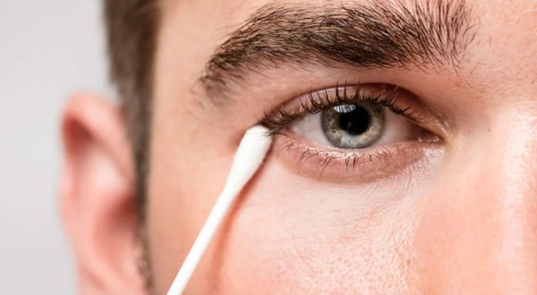 Ceratocone aumenta risco de catarata em jovens