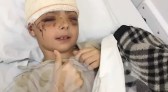 Menino atropelado pela mãe recebe alta do hospital