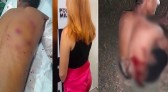 Mulher esfaqueia marido após sonhar que estava sendo traída