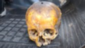 Suposto crânio humano é encontrado em lixeira no Bairro Vila Nova