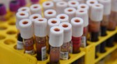 Junho Vermelho: Secretaria de Saúde reforça importância da doação de sangue