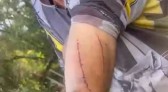 Agricultor de 76 anos sobrevive após lutar com onça-parda no Paraná